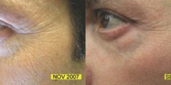 Article teaser image