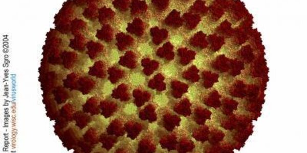 Article teaser image