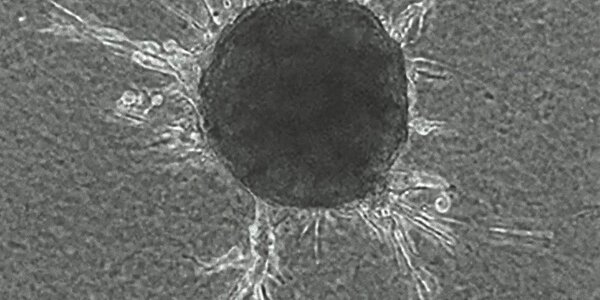 Article teaser image