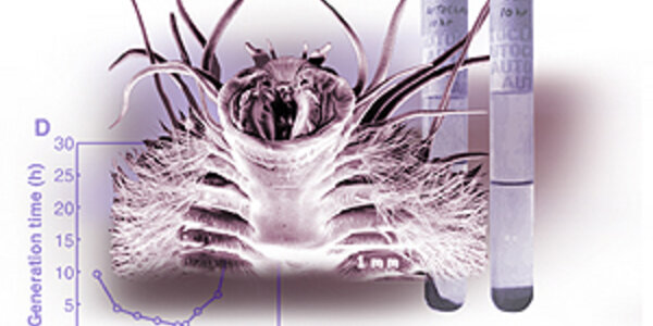 Article teaser image