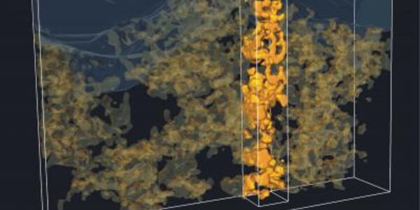 Article teaser image