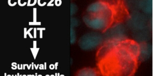 Article teaser image