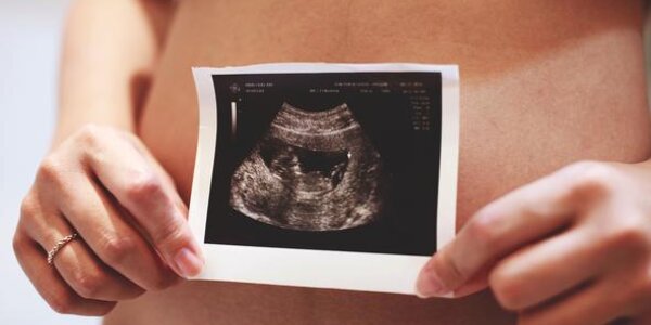 Article teaser image