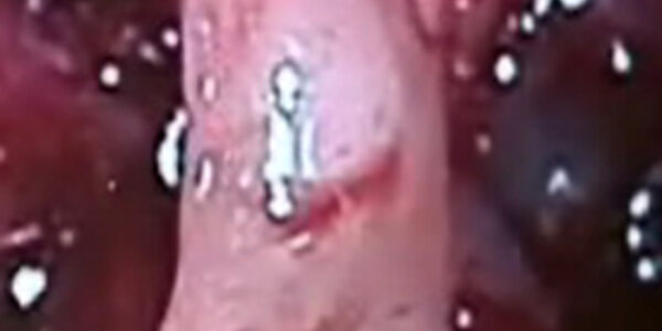 Article teaser image