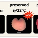 Article teaser image