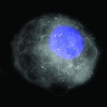 Article teaser image