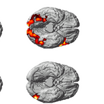 Article teaser image