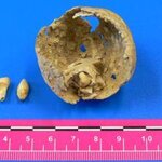 Article teaser image