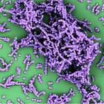 Article teaser image