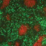 Article teaser image