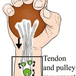 Article teaser image