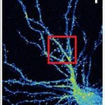 Article teaser image