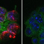 Article teaser image