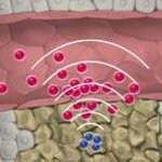 Article teaser image