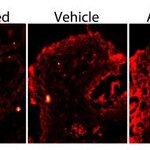 Article teaser image