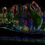 Article teaser image