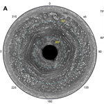 Article teaser image