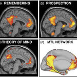 Article teaser image