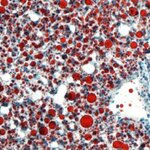 Article teaser image