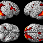 Article teaser image