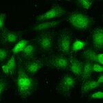 Article teaser image