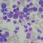 Article teaser image