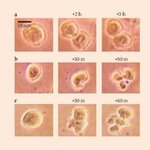 Article teaser image