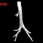 Article teaser image