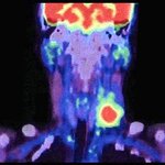 Article teaser image