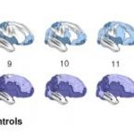 Article teaser image