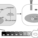 Article teaser image