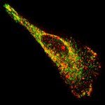 Article teaser image