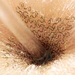 Article teaser image