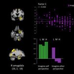 Article teaser image