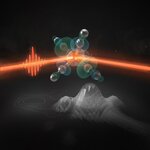 Article teaser image