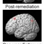 Article teaser image