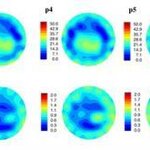 Article teaser image