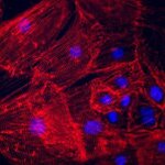 Article teaser image