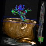 Article teaser image