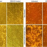 Article teaser image