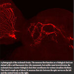 Article teaser image