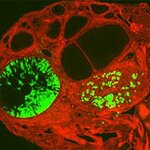 Article teaser image