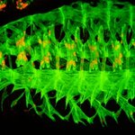 Article teaser image