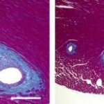 Article teaser image