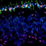 Article teaser image