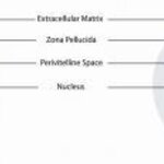 Article teaser image