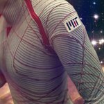 Article teaser image