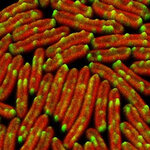 Article teaser image