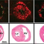 Article teaser image