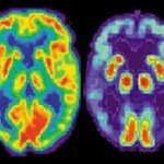 Article teaser image